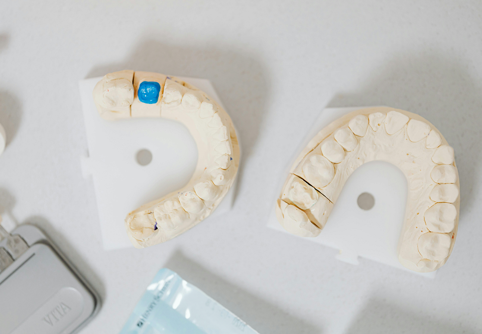 New Dental Implant Smile