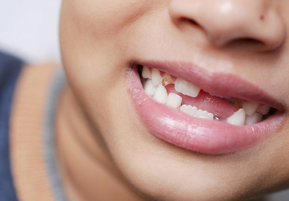 Periodontist Newtown PA