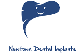 New Dental Implant Smile
